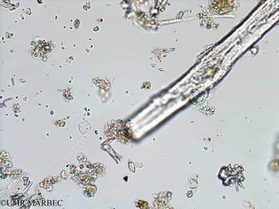 phyto/Bizerte/bizerte_bay/RISCO February 2015/Oscillatoriale 7 (ancien Baie_T1-A_Cyano spp-13).tif(copy)_thumb.jpg